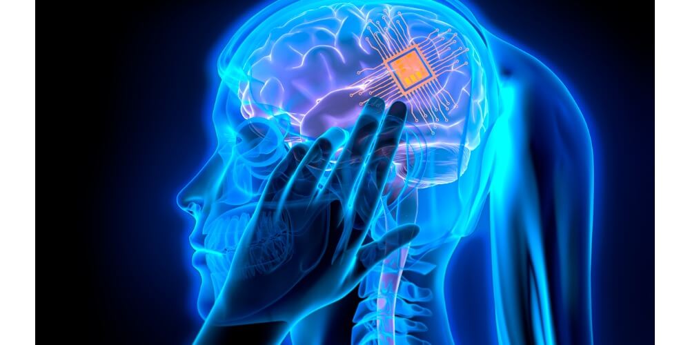 Mujer con implante cerebral Elon Musk microchip