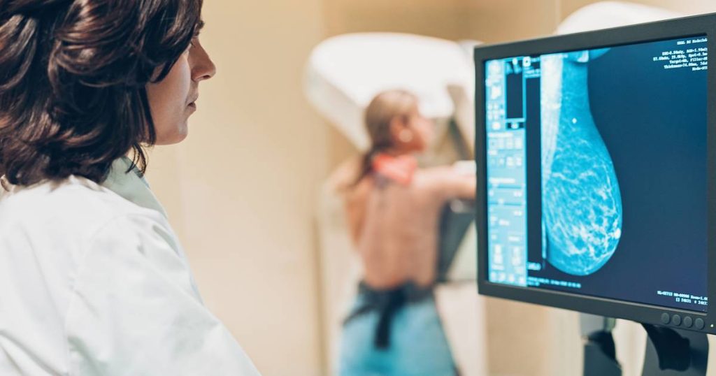 Nueva herramienta apoyada por la IA permitiría detectar el cáncer de mamá hasta 5 años antes de que se presente la enfermedad